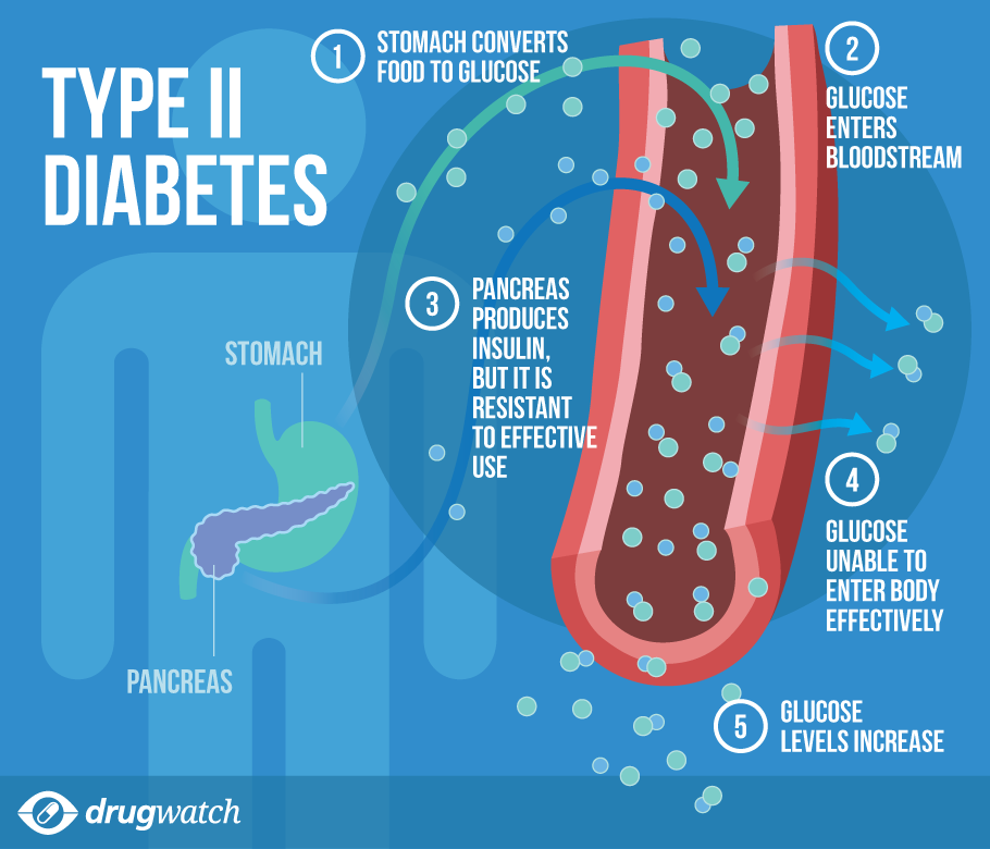 With Type 2 diabetes, your body can’t produce enough insulin to 