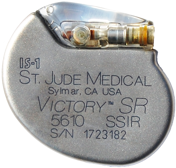 St. Jude Medical Defibrillator Implant