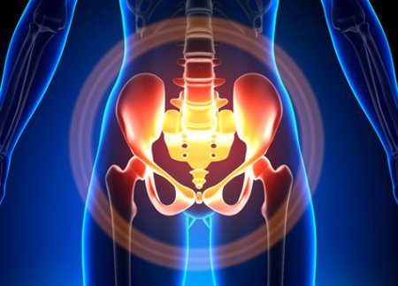 Inflamed Pelvis