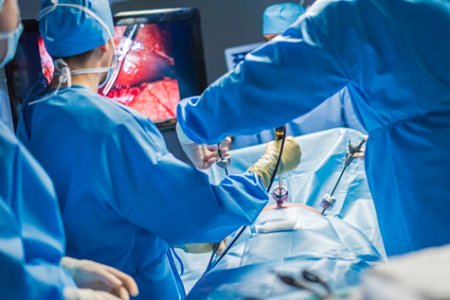 Doctors performing laparoscopic surgery