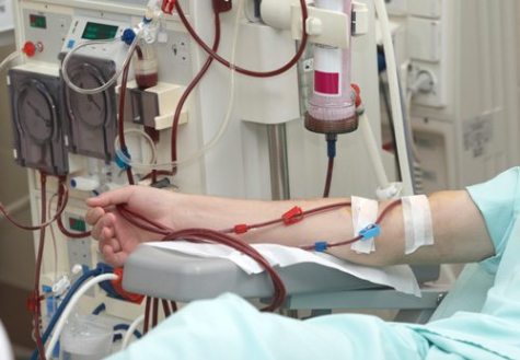Patient Hooked up to Dialysis Machine