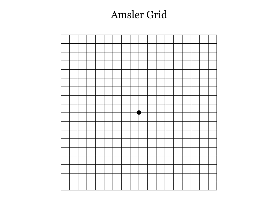 Amsler Grid Eye Test - Free Printable PDF