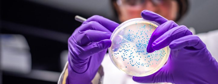 Scientist testing bacteria in petri dish