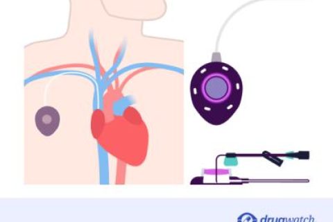 Bard PowerPort Implantable Port