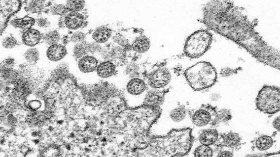 COVID-19 Microscopic Image