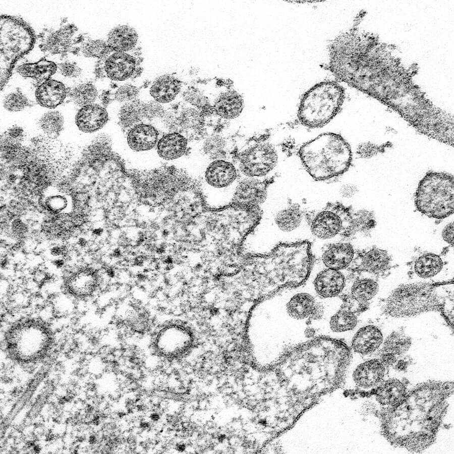 COVID-19 Microscopic Image