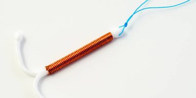 Copper IUD Device