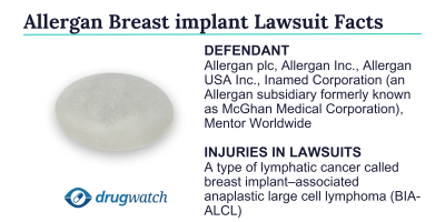 Allergan Breast Implant Lawsuit Facts including the defendant and injuries named in the lawsuits