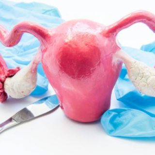 concept of birth control surgery