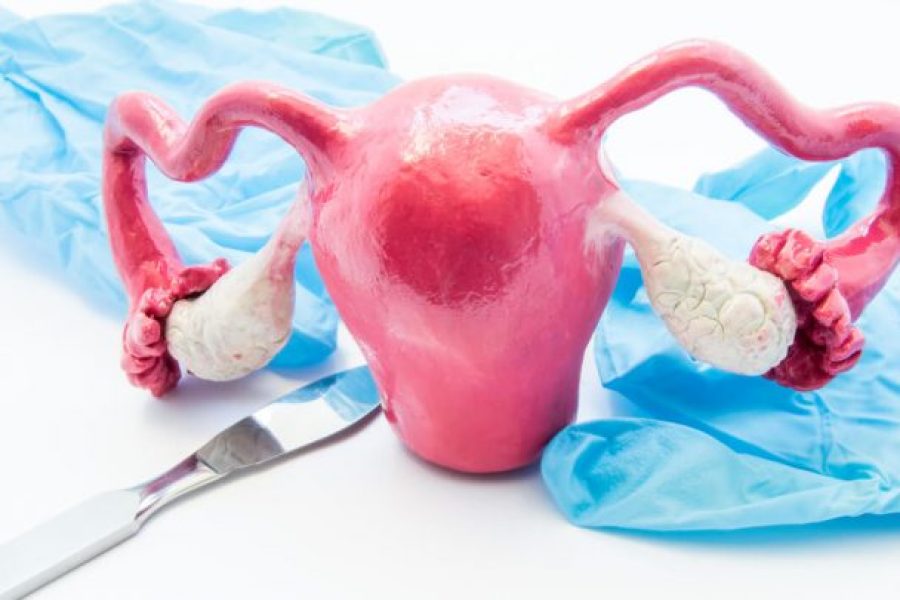 concept of birth control surgery