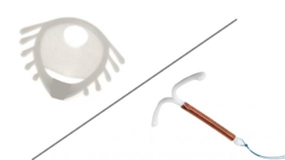 Mirena IUD and Dalkon Shield devices