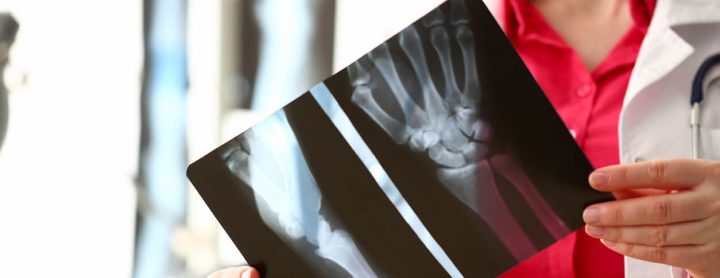 Doctor holding up wrist x-ray