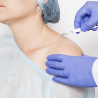 Doctor and shoulder replacement patient