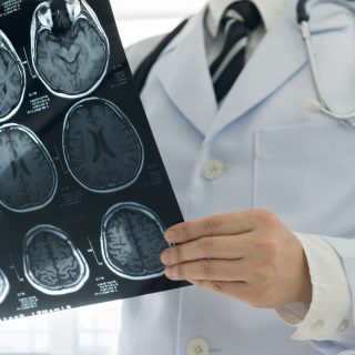 Doctor holding MRI using gadolinium