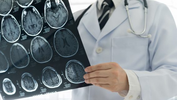 Doctor holding MRI using gadolinium