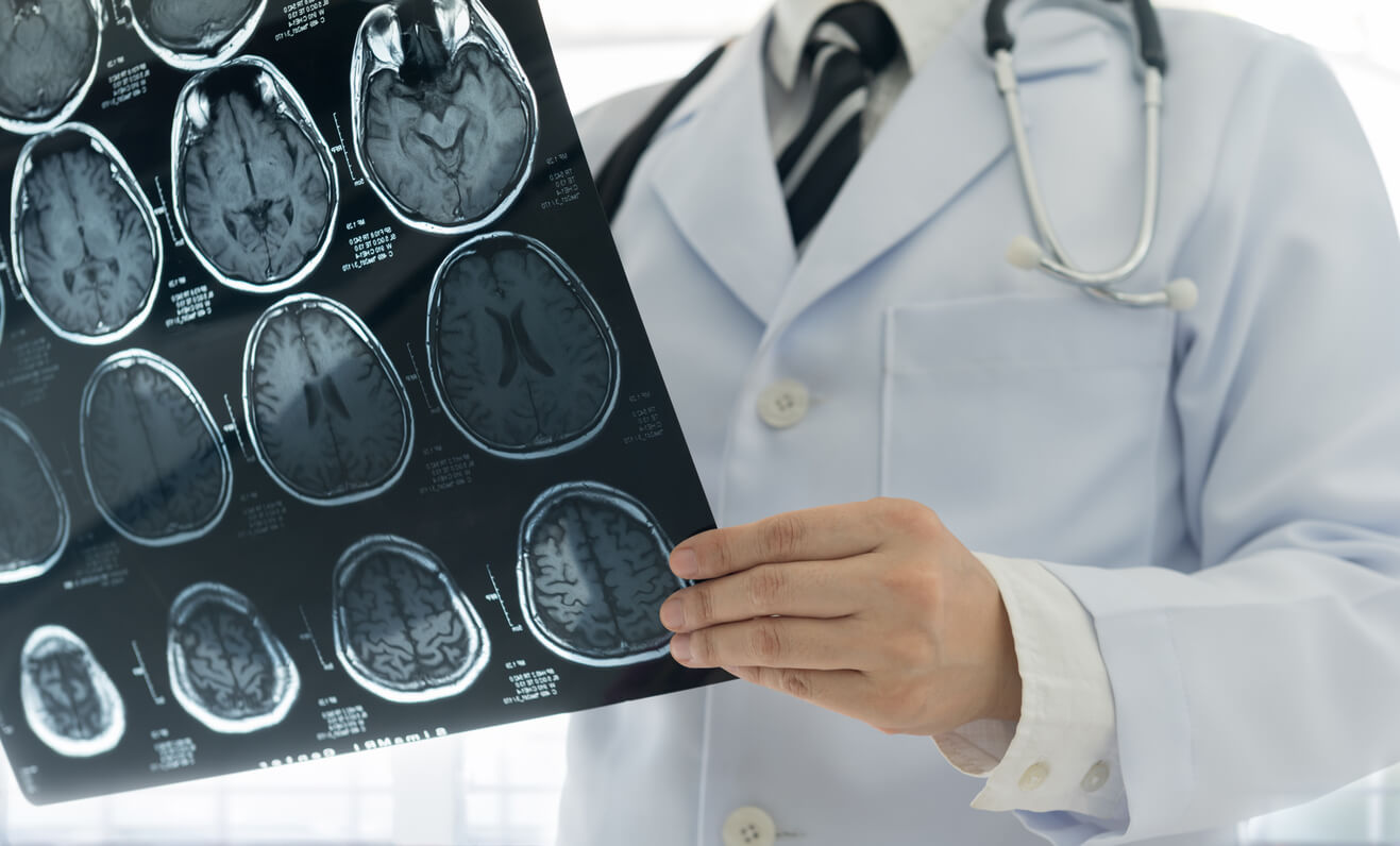 Doctor holding MRI using gadolinium