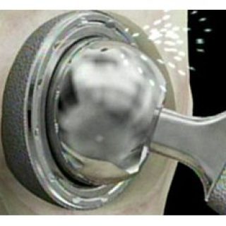 metal on metal hip implant friction