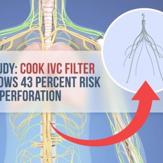 Illustration of human body and Cook IVC Filters