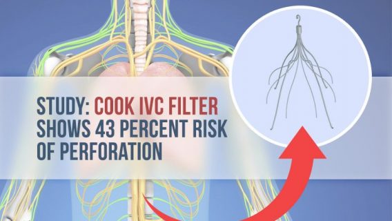 Illustration of human body and Cook IVC Filters