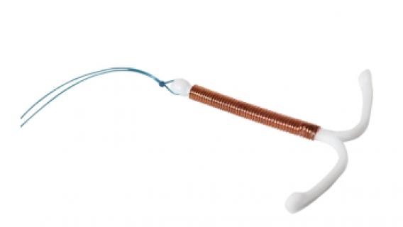 Mirena IUD