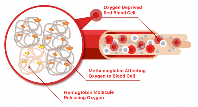 Methemoglobin illustration that shows low oxygen in the blood stream