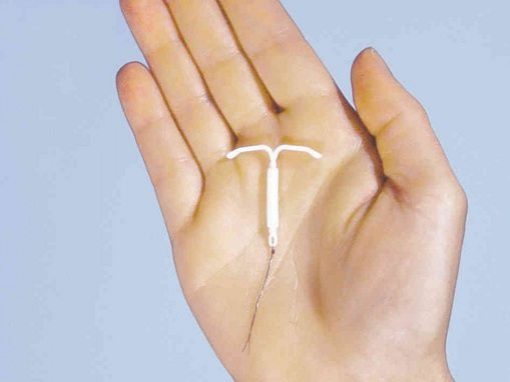 Mirena IUD in hand