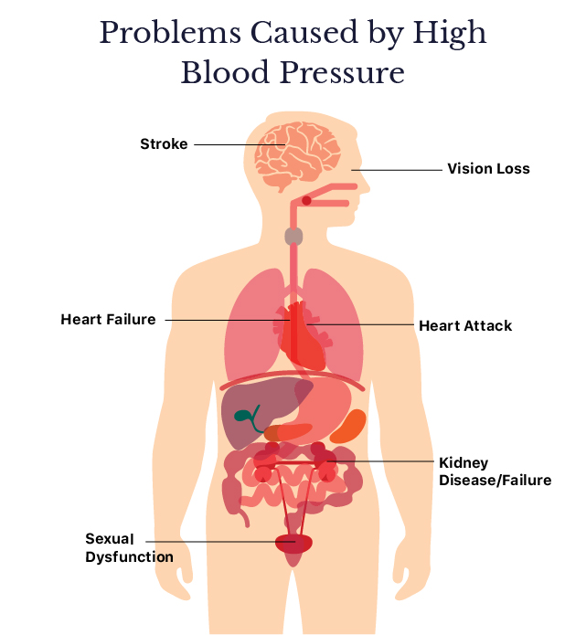 can high blood pressure cause heart attack