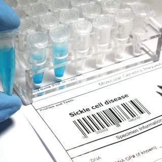 A lab technician holds a vial near a genetic test form labeled 