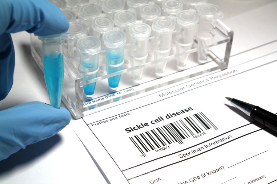 A lab technician holds a vial near a genetic test form labeled 