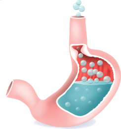 Illustration of how Protonix treats excess stomach acid.