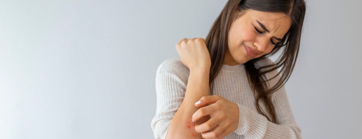 Woman with a rash on her arm