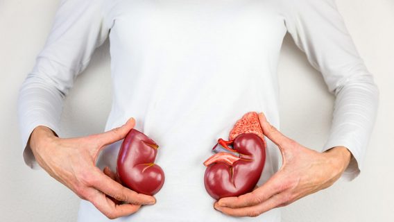 Woman holding model of kidneys
