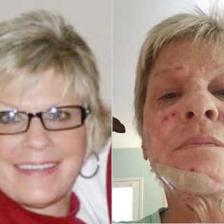 Anne Scott before and after