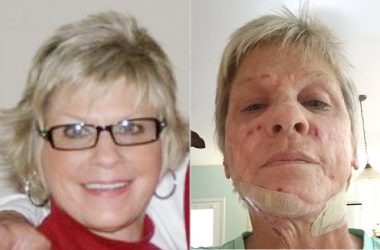 Anne Scott before and after