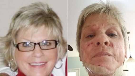 Anne Scott before and after