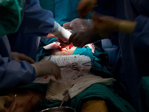 Surgeons performing aortic repair