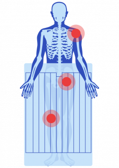 Illustration of Bair Hugger Warming Blanket