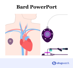 Bard PowerPort Implantable Port