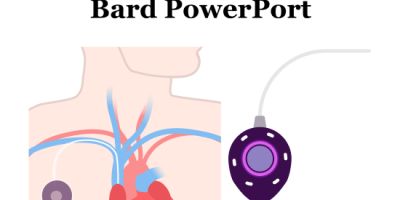 Bard PowerPort Implantable Port
