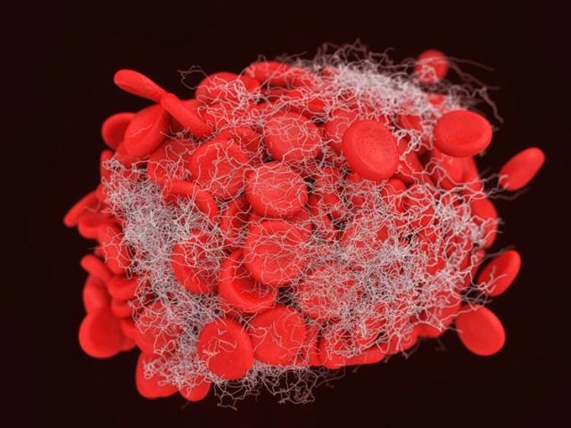 Microscopic view of a blood clot