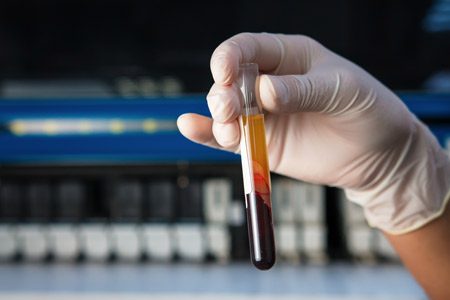 Gloved Hand Holding Test Tube in Lab