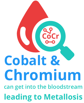 cobalt and chromium in blood stream leads to metallosis