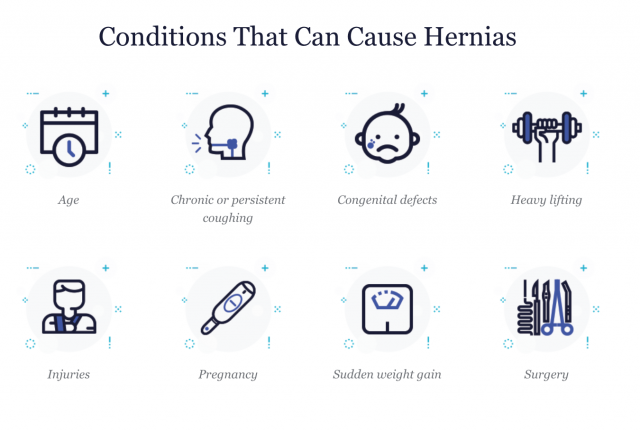 Hernias - types, causes and who's at risk