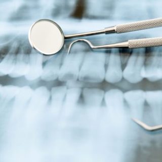 Dental tools on X-ray of teeth