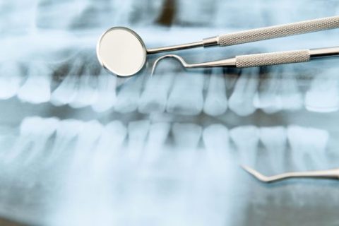 Dental tools on X-ray of teeth