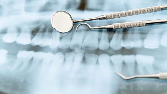 Dental tools on X-ray of teeth