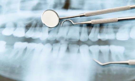 Dental tools on X-ray of teeth