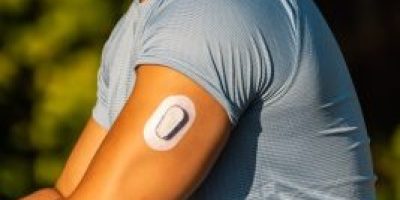 Athlete Stretching with Continuous Glucose Monitor Transmitter Adhered to Arm