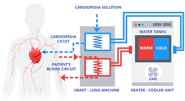 How a Heater-Cooler Functions