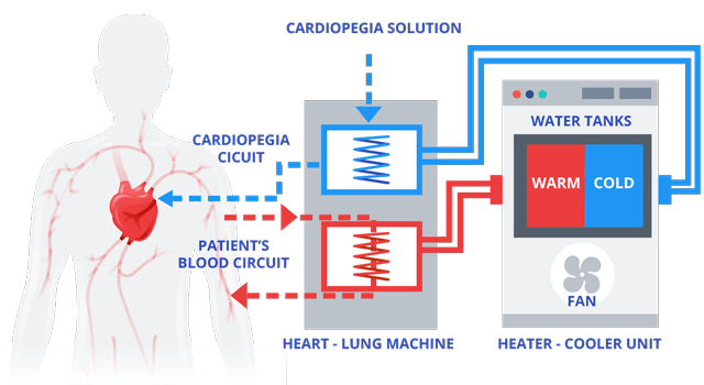 heater cooler machine